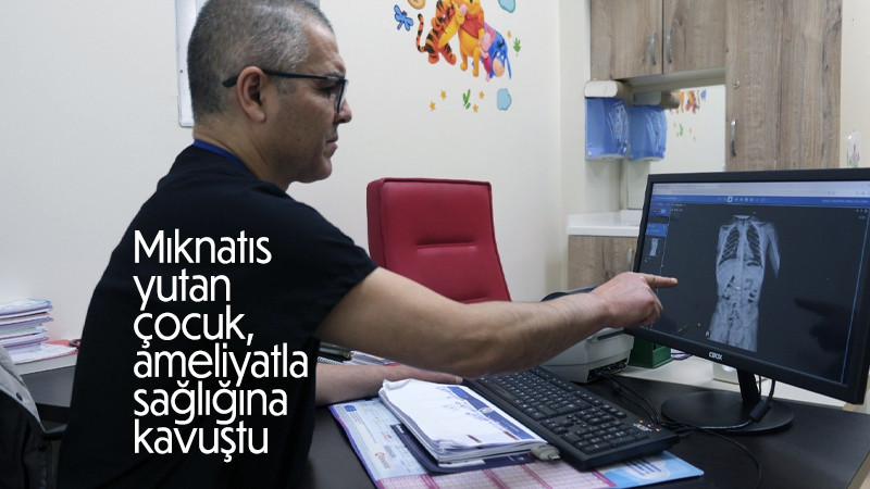 Mıknatıs yutan çocuk, ameliyatla sağlığına kavuştu