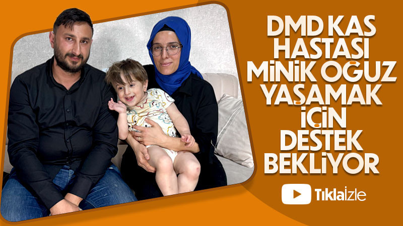 Minik Oğuz Kağan Yaşamak İçin Destek Bekliyor